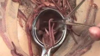 Increasing number of worms shoved inwards